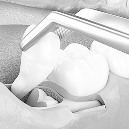 풍부한 임상경험